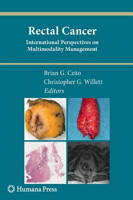 Rectal Cancer: International Perspectives on Multimodality Management - Czito, Brian G (Editor), and Willett, Christopher G (Editor)