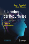 Reframing Der Bedrfnisse: Psychische Neuroimplantate