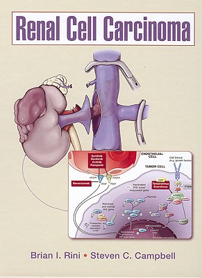 Renal Cell Carcinoma - Rini, Brian I, MD