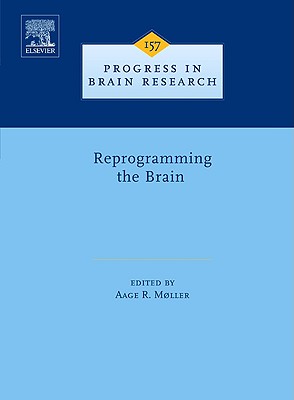 Reprogramming the Brain: Volume 157 - Moller, Aage R (Editor)