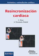 Resincronizaci?n card?aca