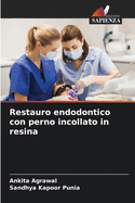 Restauro endodontico con perno incollato in resina