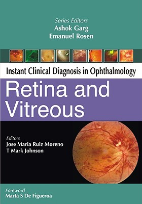 Retina and Vitreous - Moreno, Jose Maria Ruiz, and Johnson, T Mark, MD