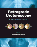 Retrograde Ureteroscopy: Handbook of Endourology