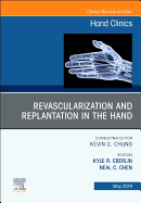 Revascularization and Replantation in the Hand, an Issue of Hand Clinics: Volume 35-2