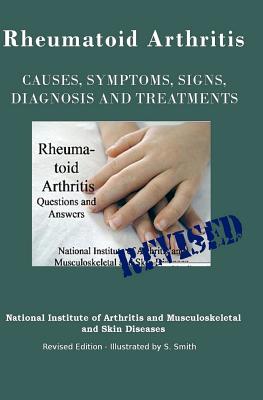 Rheumatoid Arthritis: Causes, Symptoms, Signs, Diagnosis and Treatments - Revised Edition - Illustrated by S. Smith - Institute of Mental Health, National