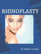 Rhinoplasty: Outpatients Surgical Guide