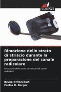 Rimozione dello strato di striscio durante la preparazione del canale radicolare