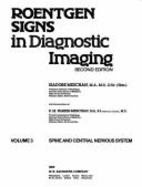 Roentgen Signs in Diagnostic Imaging: Spine and Central Nervous System