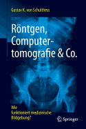 Rontgen, Computertomografie & Co.: Wie Funktioniert Medizinische Bildgebung?