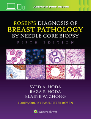 Rosen's Diagnosis of Breast Pathology by Needle Core Biopsy - Hoda, Syed A, MD, and Hoda, Raza S, and Zhong, Elaine