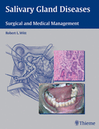 Salivary Gland Diseases: Surgical and Medical Management