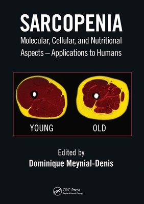 Sarcopenia: Molecular, Cellular, and Nutritional Aspects - Applications to Humans - Meynial-Denis, Dominique (Editor)