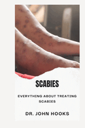 Scabies: Everything about Treating Scabies