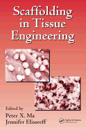 Scaffolding in Tissue Engineering