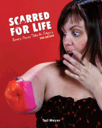 Scarred for Life. 2nd Edition: Every Scar Tells a Story
