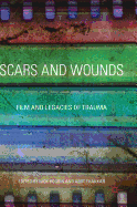 Scars and Wounds: Film and Legacies of Trauma