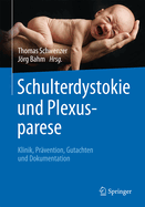 Schulterdystokie Und Plexusparese: Klinik, Prvention, Gutachten Und Dokumentation