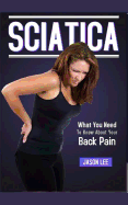 Sciatica: What You Need To Know About Your Back Pain