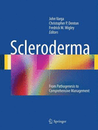 Scleroderma - Varga, John (Editor), and Denton, Christopher P. (Editor), and Wigley, Fredrick M. (Editor)
