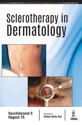 Sclerotherapy in Dermatology - S, Sacchidanand, and TS, Nagesh