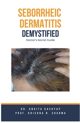 Seborrheic Dermatitis Demystified: Doctor's Secret Guide - Kashyap, Ankita, Dr., and Sharma, Prof Krishna N