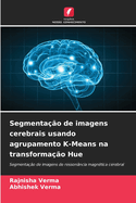 Segmenta??o de imagens cerebrais usando agrupamento K-Means na transforma??o Hue