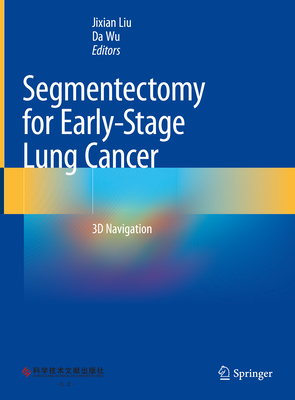 Segmentectomy for Early-Stage Lung Cancer: 3D Navigation - Liu, Jixian (Editor), and Wu, Da (Editor)