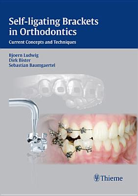 Self-Ligating Brackets in Orthodontics: Current Concepts and Techniques - Ludwig, Bjrn, and Bister, Dirk, and Baumgaertel, Sebastian