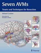 Seven Avms: Tenets and Techniques for Resection