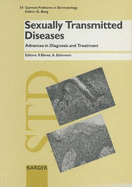 Sexually Transmitted Diseases: Advances in Diagnosis and Treatment