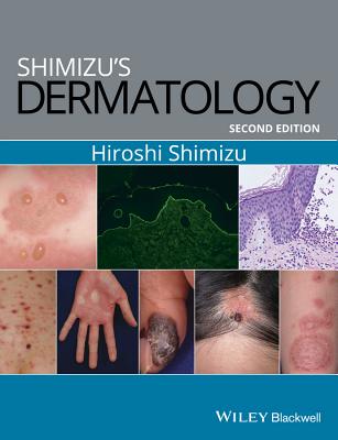 Shimizu's Dermatology - Shimizu, Hiroshi