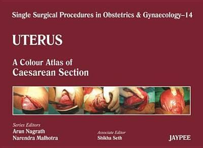 Single Surgical Procedures in Obstetrics and Gynaecology - Volume 14 - Uterus: A Colour Atlas of Caesarean Section - Nagrath, Arun
