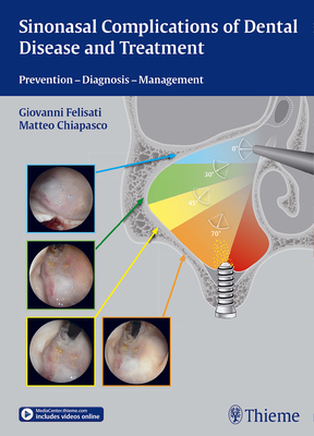 Sinonasal Complications of Dental Disease and Treatment: Prevention - Diagnosis - Management - Felisati, Giovanni (Editor), and Chiapasco, Matteo (Editor)