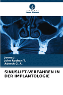 Sinuslift-Verfahren in Der Implantologie