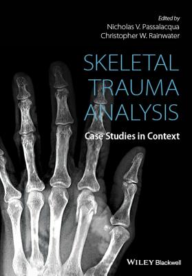 Skeletal Trauma Analysis: Case Studies in Context - Passalacqua, Nicholas V. (Editor), and Rainwater, Christopher W. (Editor)