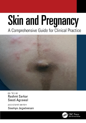 Skin and Pregnancy: A Comprehensive Guide for Clinical Practice - Sarkar, Rashmi (Editor), and Agrawal, Swati (Editor), and Jagadeesan, Soumya (Editor)