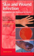 Skin and Wound Infection: Investigation and Treatment in Practice