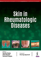 Skin in Rheumatologic Diseases