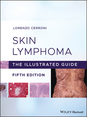 Skin Lymphoma - Cerroni, Lorenzo