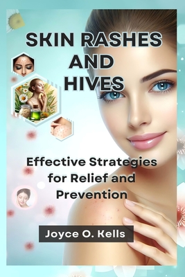 Skin Rashes and Hives: Effective Strategies for Relief and Prevention - Kells, Joyce O