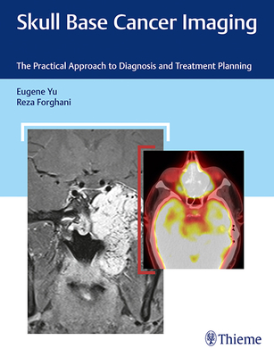 Skull Base Cancer Imaging: The Practical Approach to Diagnosis and Treatment Planning - Yu, Eugene, and Forghani, Reza