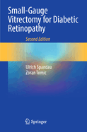 Small-Gauge Vitrectomy for Diabetic Retinopathy