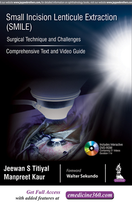 Small Incision Lenticule Extraction (SMILE): Surgical Technique and Challenges: Comprehensive Text and Video Guide - Titiyal, Jeewan S, and Kaur, Manpreet