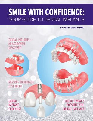 Smile with confidence: Your guide to dental implants - Babiner DMD, Maxim