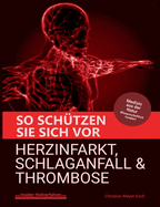 So sch?tzen Sie sich vor Herzinfarkt, Schlaganfall und Thrombose