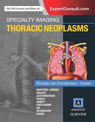 Specialty Imaging: Thoracic Neoplasms - Rosado-De-Christenson, Melissa L, and Carter, Brett W, MD