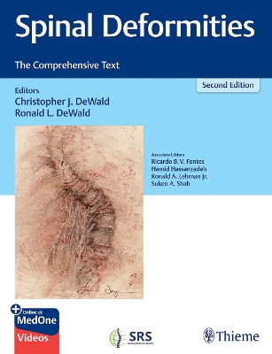 Spinal Deformities: The Comprehensive Text - DeWald, Christopher, and DeWald, Ronald