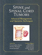 Spine and Spinal Cord Tumors: Advanced Management and Operative Techniques