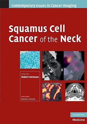 Squamous Cell Cancer of the Neck - Hermans, Robert (Editor)